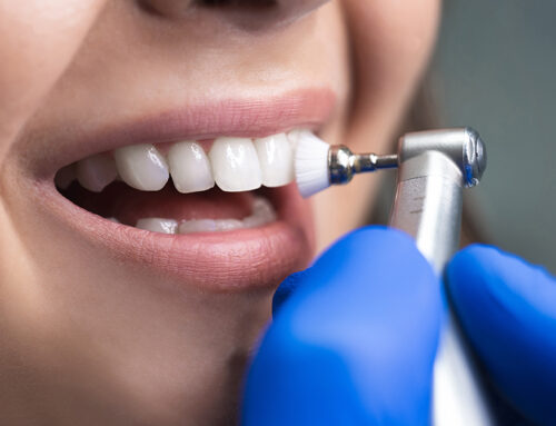 The Importance of Semi-annual Dental Check-ups: Nurturing Your Smile and Well-being